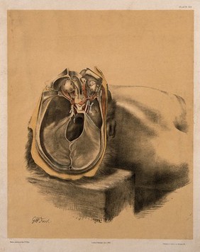 Dissection of the skull, showing the eyes with attached nerves and muscles. Colour lithograph by G.H. Ford, 1864.