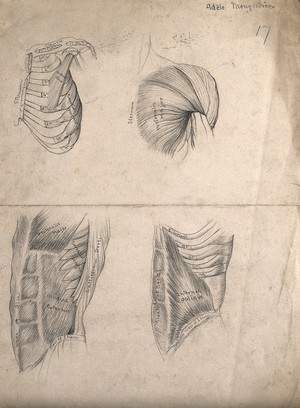 view Muscles of the trunk: four figures, including the ribcage and shoulder. Pencil drawing by A. Mongrédien, ca. 1880.