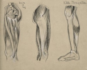 view Muscles of the leg and foot: three figures. Pencil and chalk drawing by A. Mongrédien, ca. 1880.