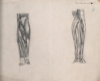 Muscles of the arm [?]: two figures. Pencil drawing by J. Mongrédien, ca. 1880.