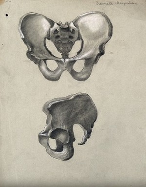 view Pelvic bone: front and side views. Pencil and chalk drawing by J. Mongrédien, ca. 1880.