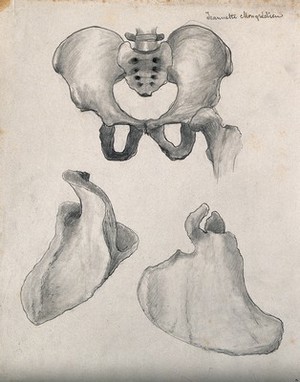 view Bones of the pelvis and scapula: three figures. Pencil and chalk drawing by J. Mongrédien, ca. 1880.