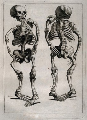 The skeleton of a child with deformed limbs: two figures showing anterior and posterior views. Etching by Lavalée after J. Gamelin, 1778.