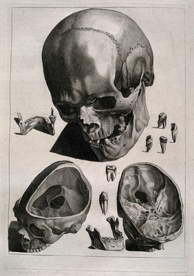 Human skull, with details showing the teeth and bones of the lower jaw and two sections through the skull. Etching by or after J. Gamelin, 1778/1779.