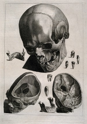 view Human skull, with details showing the teeth and bones of the lower jaw and two sections through the skull. Etching by or after J. Gamelin, 1778/1779.