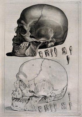 Human skull, with details showing the teeth: above, a tonal etching of the skull, below, an outline diagram. Etching by or after J. Gamelin, 1778/1779.
