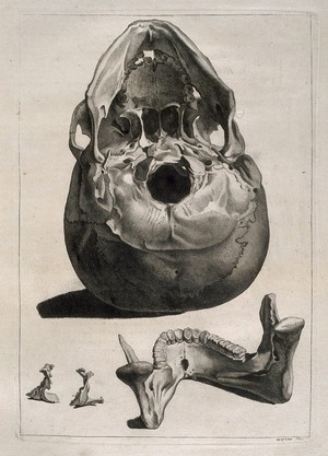view Human skull, seen from below, with details of the lower jaw bone. Etching by Martin after J. Gamelin, 1778/1779.