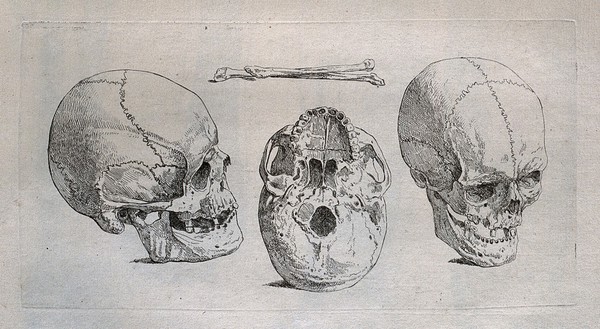 Three skulls, seen from different angles, with two limb bones shown above. Etching by or after J. Gamelin, 1778/9.