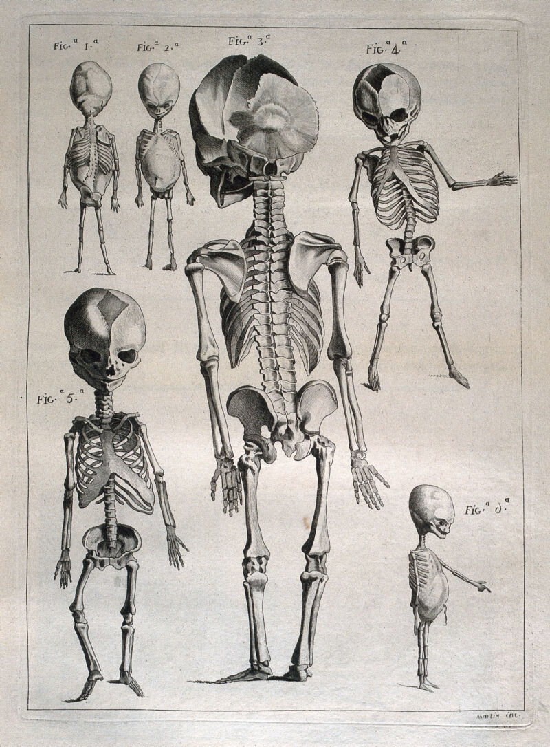 Foetal skeletons: six figures. Etching by Martin after J. Gamelin, 1778/1779., [1779], by Jacques Gamelin