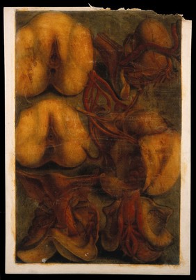 Dissections of the female urogenital system: six figures. Colour mezzotint by J. F. Gautier d'Agoty after himself, 1754.