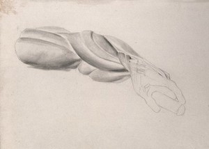 view Muscles of the arm and hand, shown in a similar pose to that of the 'Borghese Gladiator' by Agasias of Ephesus. Pencil and chalk (?) drawing by J.C. Zeller (?), ca. 1832.