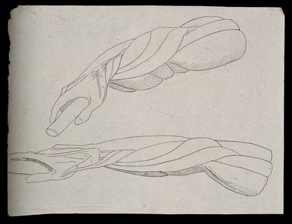 Muscles of the arm and hand: four figures (two on verso), showing the hand in a similar pose to that of the 'Borghese Gladiator' by Agasias of Ephesus. Pen and ink drawing by J.C. Zeller (?), ca. 1832.