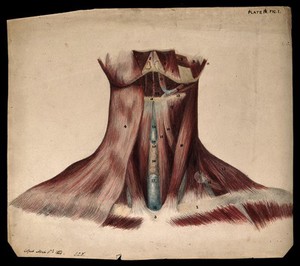 view Dissection of the back of the neck. Watercolour and pencil drawing, copied by J.C. Whishaw, 1854.