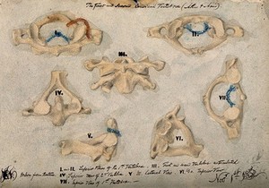 view The first and second cervical vertebrae. Watercolour, pencil and crayon drawing by J.C. Whishaw, 1852.