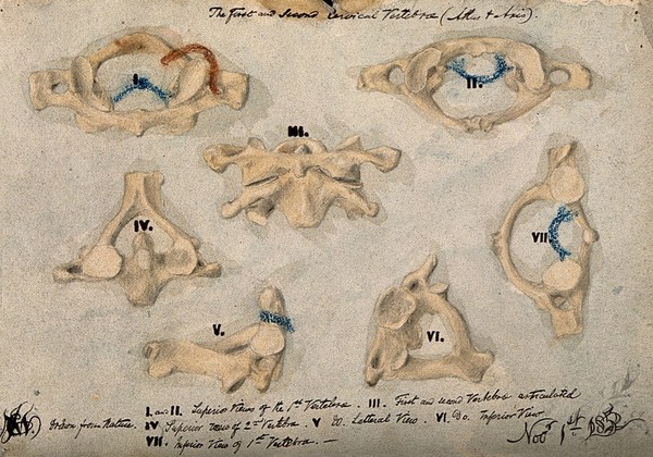 The first and second cervical vertebrae. Watercolour, pencil and crayon drawing by J.C. Whishaw, 1852.