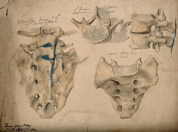 The sacrum, shown with the second, third and fifth lumbar vertebrae: four figures. Watercolour, pencil and crayon drawing by J.C. Whishaw, 1853.