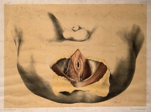 view Dissection of the area surrounding the anus of a man, with the muscles and blood vessels indicated. Colour lithograph by G.H. Ford, 1865.