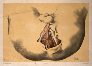 view Dissection of the area surrounding the anus and genitalia of a man, with the muscles and blood vessels indicated. Colour lithograph by G.H. Ford, 1865.