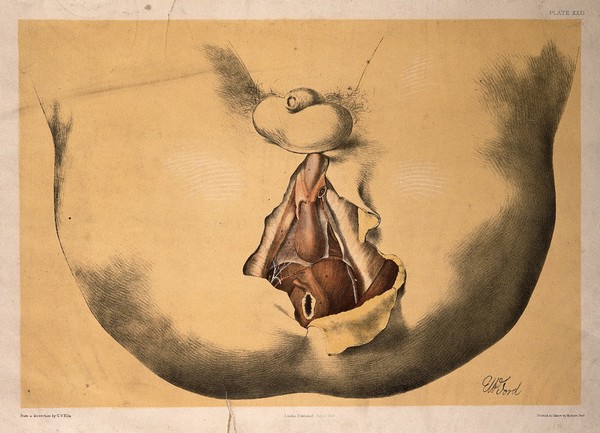 Dissection of the area surrounding the anus and genitalia of a man, with the muscles and blood vessels indicated. Colour lithograph by G.H. Ford, 1865.