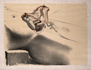 view Dissection of the groin and lower abdomen of a man, with the muscles and blood vessels indicated. Colour lithograph by G.H. Ford, 1865.