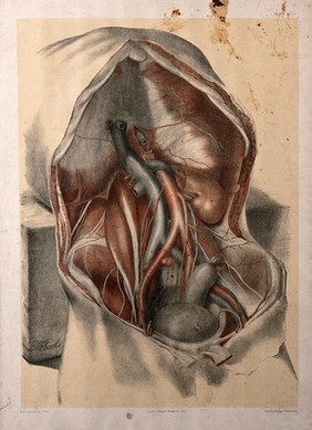 Dissection of the abdomen of a man, showing the arteries, veins, and internal organs. Colour lithograph by G.H. Ford, 1865.