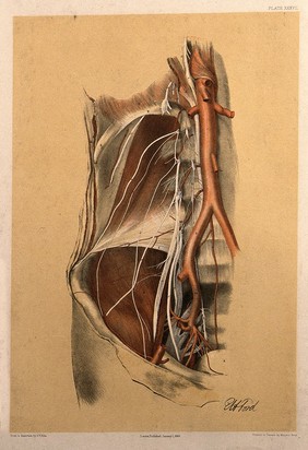Dissection of the abdomen of a man, showing the arteries, blood vessels and muscles. Colour lithograph by G.H. Ford, 1866.