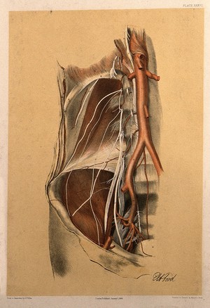 view Dissection of the abdomen of a man, showing the arteries, blood vessels and muscles. Colour lithograph by G.H. Ford, 1866.