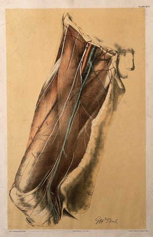 view Dissection of the thigh of a man, showing the muscles, arteries, veins and blood vessels. Colour lithograph by G.H. Ford, 1866.