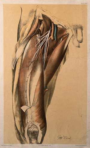 view Dissection of the thigh of a man, showing the muscles, arteries, veins and blood vessels. Colour lithograph by G.H. Ford, 1866.