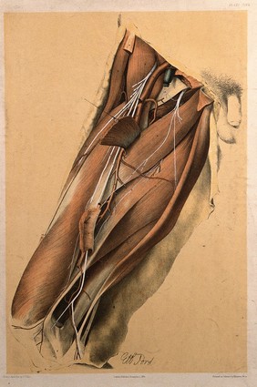 Dissection of the thigh of a man, showing the muscles, arteries, veins and blood vessels. Colour lithograph by G.H. Ford, 1866.