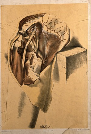 view Dissection of the hip, upper thigh and buttock of a man, showing the muscles and blood vessels. Colour lithograph by G.H. Ford, 1867.