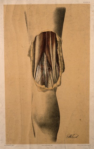 view Dissection of the back of the leg, showing the muscles, tendons and blood vessels of the back of the thigh and knee joint. Colour lithograph by G.H. Ford, 1867.