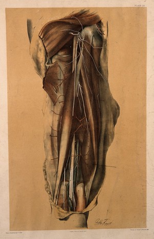 view Dissection of the back of the thigh, showing the muscles, tendons, blood vessels and arteries. Colour lithograph by G.H. Ford, 1867.