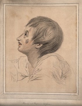 Head of a youth whose face is difficult to analyse physiognomically. Drawing, c. 1794.