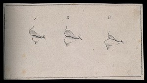 view Three mouths with variously projecting lips. Drawing, c. 1793.