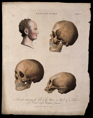 A profile of a man bisected with a curve for measuring the brain, skulls of a Turk (top right), a Georgian woman (bottom left) and a Caribbean (bottom right). Coloured engraving by H. Adlard, 1824.