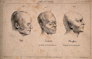 view Three portraits shown for their phrenological exemplarity: Gall, Eustache and Chauffron. Lithograph by C. Picard, 1842, after J.P. Thenot.