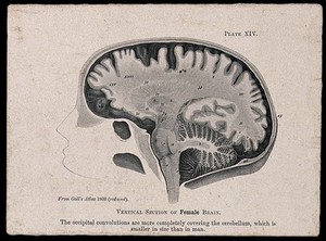 A female brain, sectioned vertically: side view. Process print