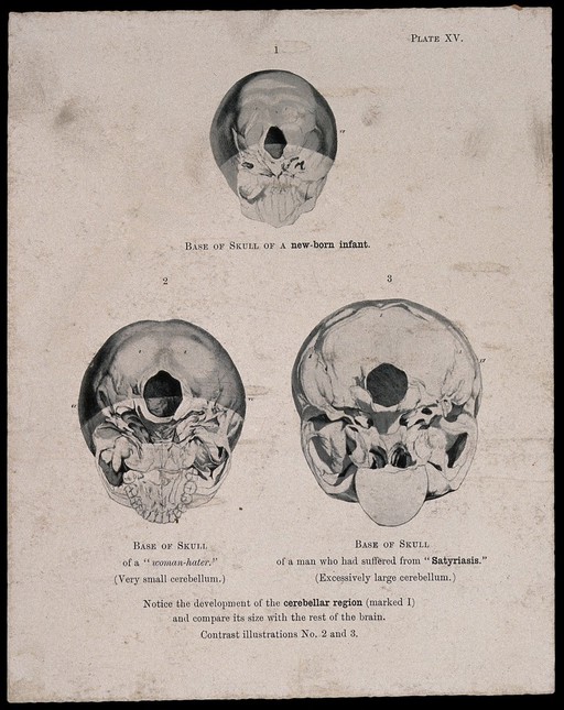 The bases of three skulls: a new born infant's, a misognynist's, and a man suffering from satyriasis. Photomechanical reproduction, 1901, after etching, 1809.
