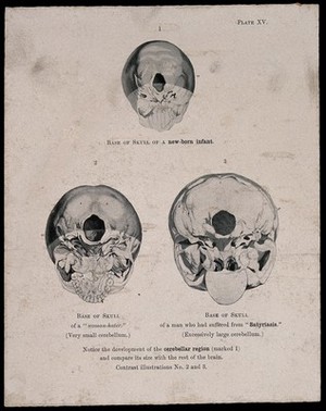 view The bases of three skulls: a new born infant's, a misogynist's, and a man suffering from satyriasis. Process print, 1901, after etching, 1809.