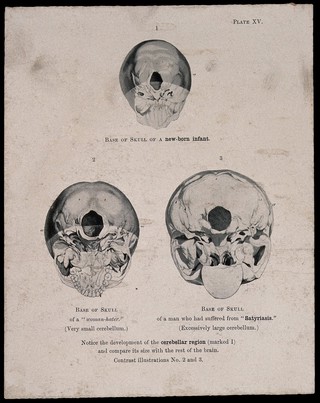 The bases of three skulls: a new born infant's, a misogynist's, and a man suffering from satyriasis. Process print, 1901, after etching, 1809.