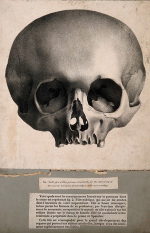 view Scull of a public woman, remarkable for the depravity of her morals, her great propensity to steal and cruellty.