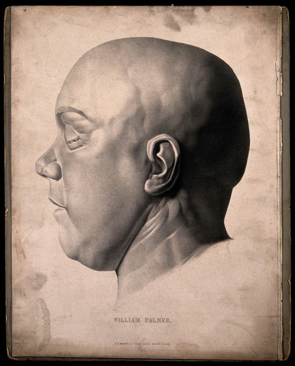 The death mask of William Palmer, the poisoner. Lithograph after M. Krantz, c. 1860.