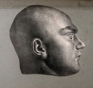view Death mask of Martin, a parricide. Lithograph, c. 1835.