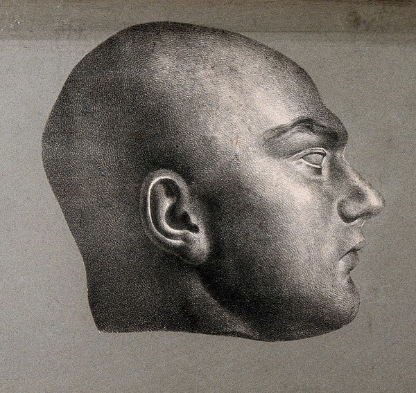 Death mask of Martin, a parricide. Lithograph, c. 1835.