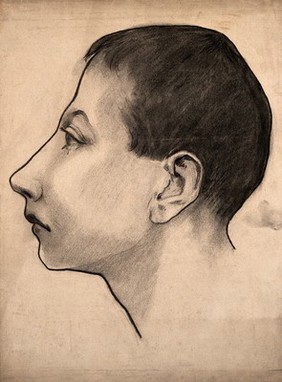 Head of a boy in profile, used to illustrate phrenological classifications of mental pathology.