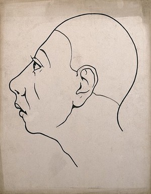 view Left profile of a head showing depressed frontal lobes. Drawing, c. 1900.