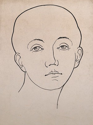 view Head of woman showing musical ability, according to phrenological classification. Drawing, c. 1900.