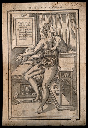 Dissection of the abdomen of a pregnant woman expecting twins: the nude woman is shown seated on a bed, lifting two placentas to reveal the two foetuses. Woodcut, 1545.