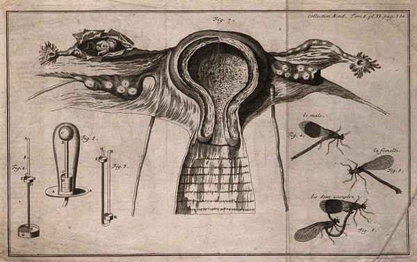 Dissection of the female reproductive organs, showing an ectopic pregnancy, together with illustrations showing surgical apparatus (?) and two insects mating. Engraving with etching, 17--?.